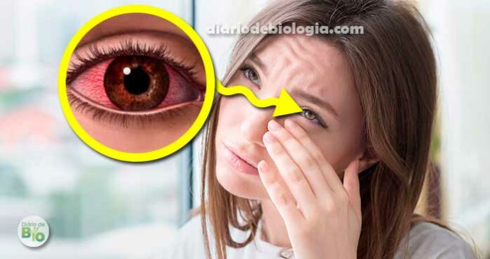 Coceira Nos Olhos Especialistas Explicam O Que Pode Ser E Como Fazer