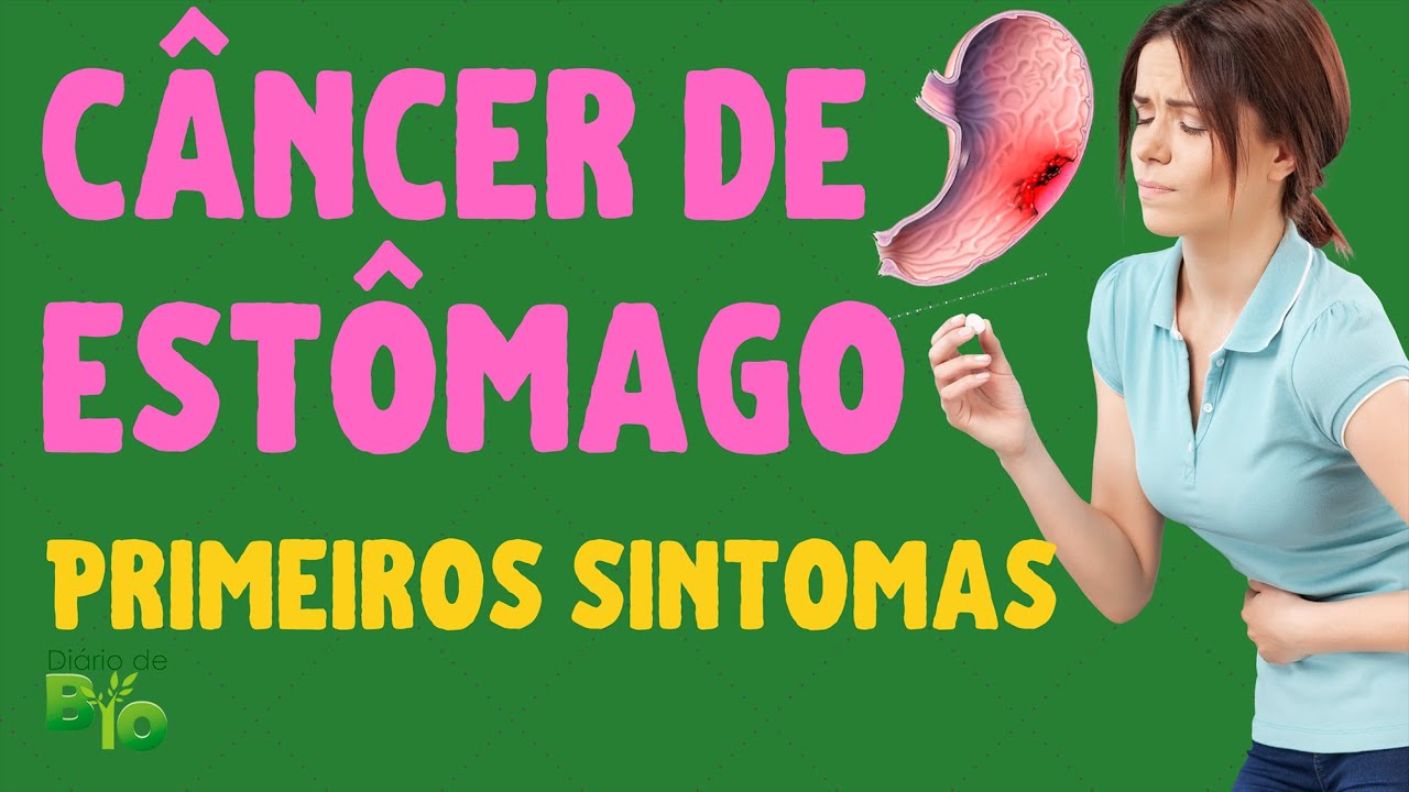 Sintomas De C Ncer No Est Mago E Seus Est Gios Atualizado