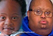 Síndrome de Down: É verdade que a doença não acontece em pessoas negras?
