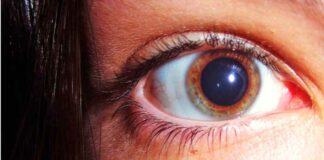 Pupila dilatada: Por que nossas pupilas contraem e dilatam
