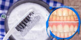 Como clarear os dentes com bicarbonato? Isso realmente funciona?
