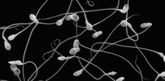 O que é esperma? O que é espermatozoide? Qual a diferença?