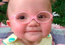 Exame de vista em bebês: como é feito? Todo bebê tem que fazer?