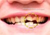 Antibióticos estragam os dentes? Dentistas explicam se isso é verdade