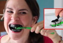 Dentes brancos: É verdade que o carvão ativado clareia os dentes