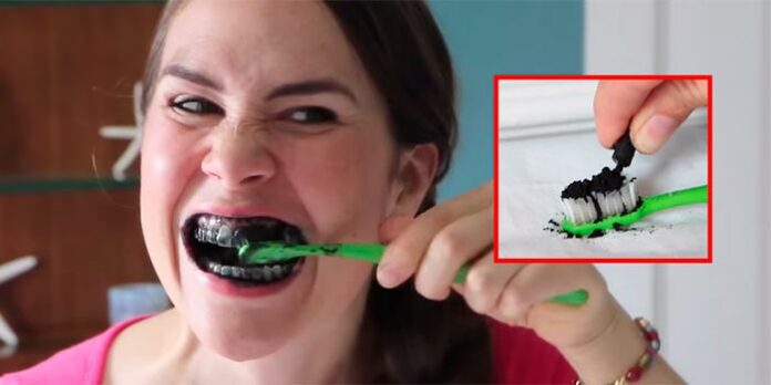 Dentes brancos: É verdade que o carvão ativado clareia os dentes