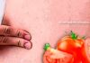 Dor da apendicite: comer sementes de tomate causa apendicite