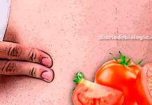 Dor da apendicite: comer sementes de tomate causa apendicite