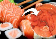 Verme do sushi: depois de comer comida japonesa mulher fica com vermes no estômago