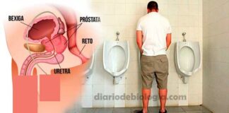 Sintomas de câncer de próstata: 5 primeiros sintomas que os homens sentem