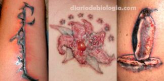 Como saber se a tatuagem recente está infeccionada?