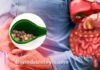 Sintomas de pedra na vesícula: tudo que você pode sentir