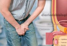 Dor ao urinar: doenças nos homens que causam dor durante o xixi