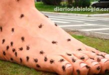 Tudo sobre PAF: Polineuropatia Amiloidótica Familiar - a Doença do pé gigante