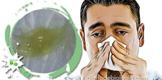 Catarro verde: 6 doenças que causam muco verde
