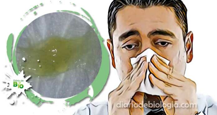 Catarro verde: 6 doenças que causam muco verde
