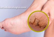 pés ressecados dermatologista explica o que pode estar causando esse problema