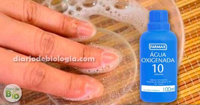 Micose de unha: médica ensina receita caseira com água oxigenada que mata o fungo
