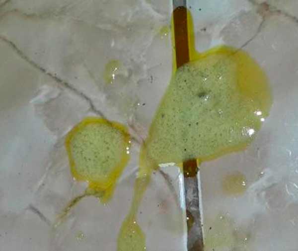 vomito verde amargo e diarreia