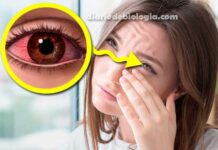 Olhos coçando: o que pode ser e como tratar a coceira nos olhos