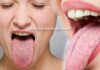 Acordar com a boca seca: o que pode ser? É doença? O que fazer?