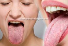 Acordar com a boca seca: o que pode ser? É doença? O que fazer?