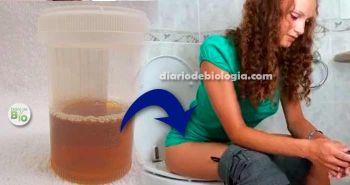 Urina escura: possíveis causas - IMEB