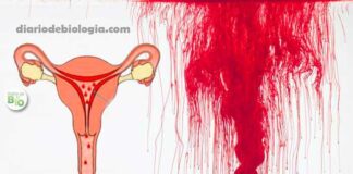 Como diminuir o fluxo menstrual intenso? O que fazer?
