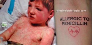 Alergia a penicilina: Como saber se sou alérgico a penicilina?