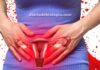 Menstruação: Fluxo menstrual intenso pode ser doença? Veja as causas