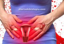 Menstruação: Fluxo menstrual intenso pode ser doença? Veja as causas
