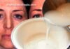Água de arroz clareia a pele do rosto: Como fazer e como usar?