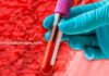 Menstruação: Do que é feita? Qual a composição do sangue menstrual?