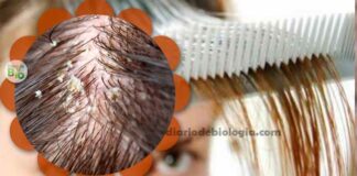 Oleosidade nos cabelos: Como acabar com cabelos oleosos para sempre