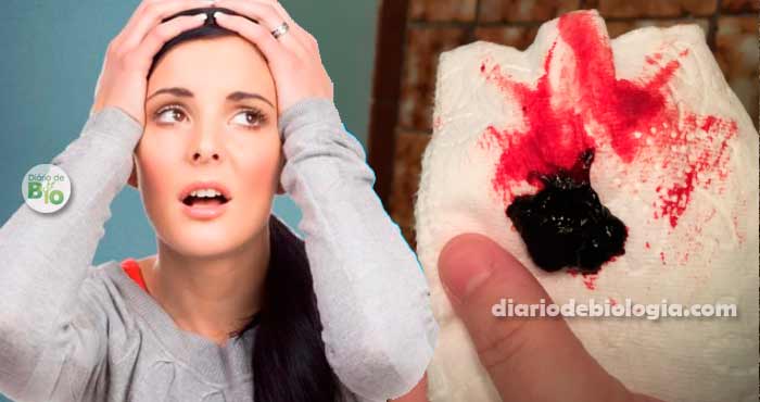 Menstruação com pedaços de sangue é normal? 
