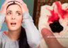 Menstruação com coágulos: O que pode ser? É normal?
