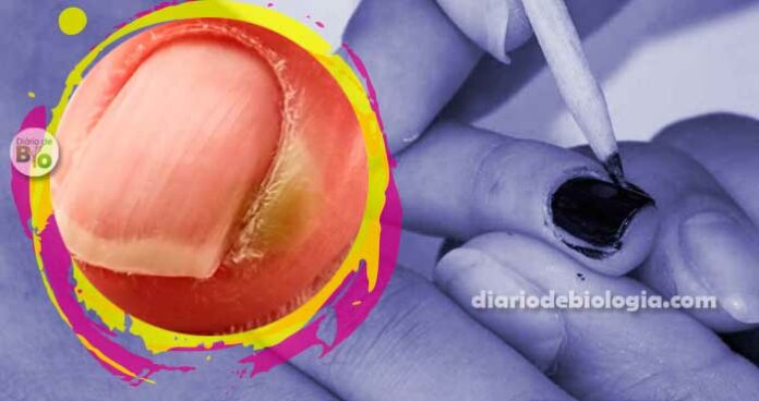 Fazer as unhas: perigos e riscos de tirar cutículas, lixar e pintar as unhas