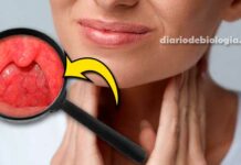 Dor na garganta: Como saber se a garganta está inflamada?