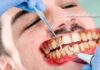 Higiene bucal: não escovar os dentes pode causar pneumonia e infarto