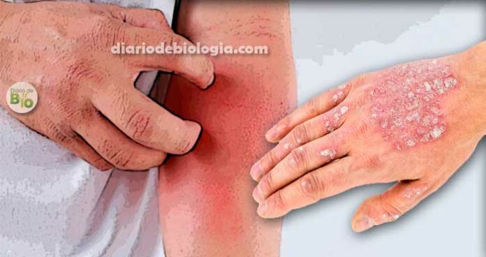 Manchas vermelhas na pele: vejas as causas mais comuns