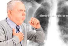 Pneumonia vs bronquite: qual a diferença de sintomas?