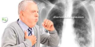 Pneumonia vs bronquite: qual a diferença de sintomas?