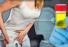 Sintomas de infecção urinária: Confirme de sua dor é infecção de urina