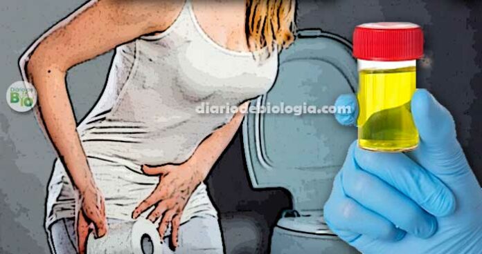 Sintomas de infecção urinária: Confirme de sua dor é infecção de urina