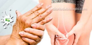 Dor nas juntas: Doenças que causam dores nas articulações
