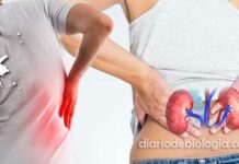 Dor nos rins: Quais os sintomas e as causas? Quando ir ao médico?