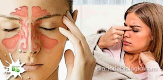 Sintomas da sinusite: como saber se tenho ou se estou com Sinusite?