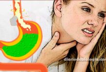 Sintomas de refluxo gastroesofágico: como saber se você tem