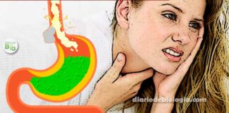 Sintomas de refluxo gastroesofágico: como saber se você tem
