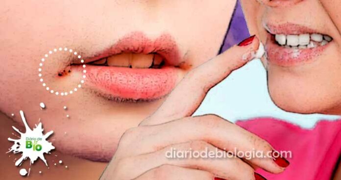 Ferida no canto da boca: imagens, sintomas, causas e tratamentos
